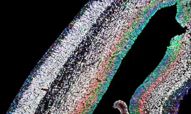 大脑发育之路：从胚胎时期的干细胞到包含150亿神经元的大脑皮层