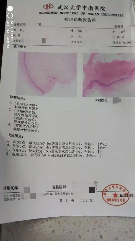 来了来了，我要的活检结果终于来了