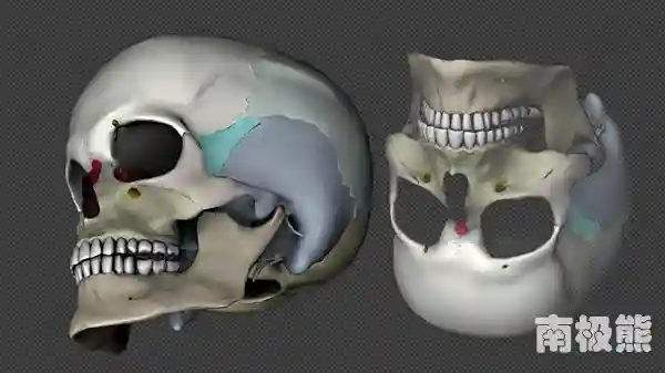 爱尔兰在3D打印骨骼植入物方面取得新突破