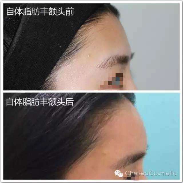 云南首款细胞1类新药进入注册临床试验阶段