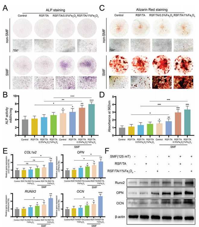 做完祛眼袋手术后，这些是可能出现的