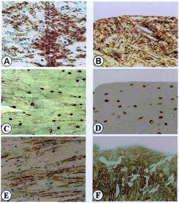 新发现活性多肽可治疗缺血性脑卒中