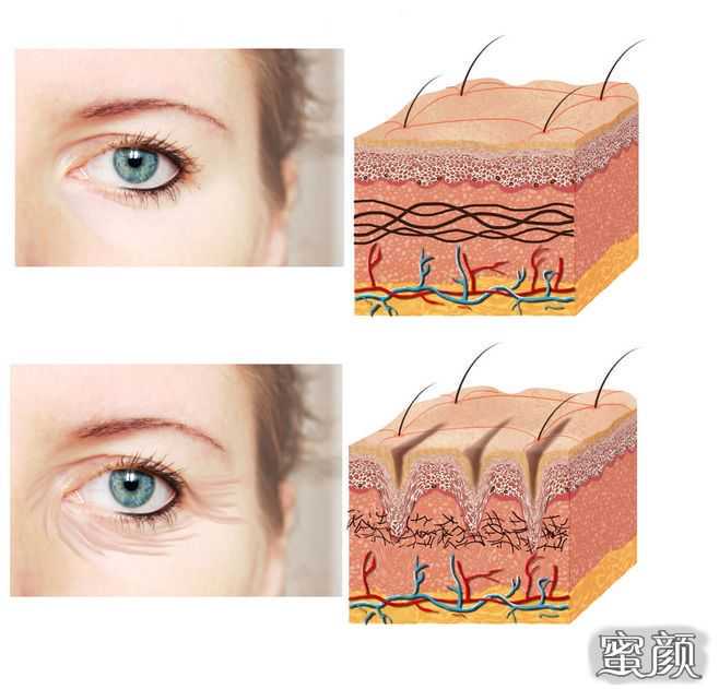 体检又发现一堆结节、囊肿、增生？这几类标红的情况必须高度警惕！