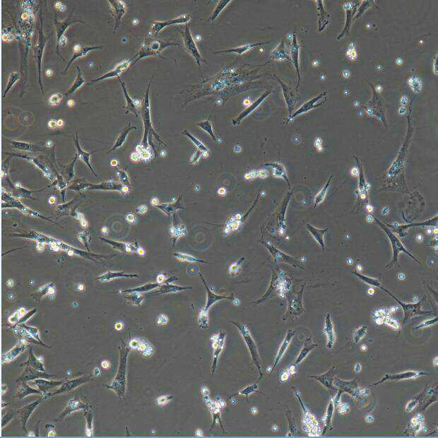 哪些人能抽脂减肥？到底危不危险？看这一篇全明白