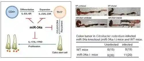 研究发现肠炎向肠癌转化的新机制