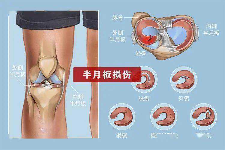 执牛耳者｜妻子的坚持让他更坚强 人造精子开启新突破